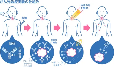 免疫療法