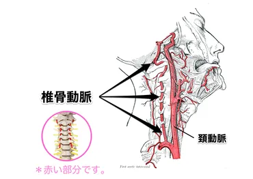 首の骨と椎骨動脈解離の正しい知識。自分の体は自分で守りましょう。 