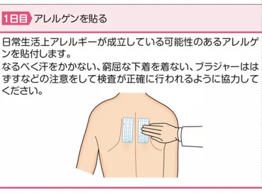 かぶれ（接触性皮膚炎）の治療 