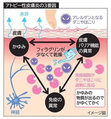 特集・アトピー性皮膚炎】教えてドクター・新薬で「症状ゼロ」へ／お薬相談室・入浴後５分以内に保湿【元気＋らいふ】 