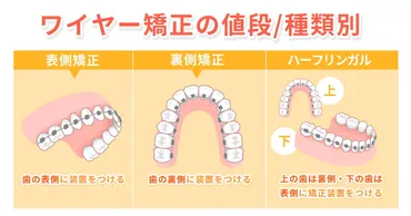 ハーフリンガル矯正とは？値段やメリット・デメリットを徹底解説