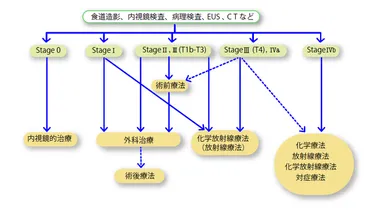 食道がんの手術はどの場合に行う？―ステージごとの集学的治療 