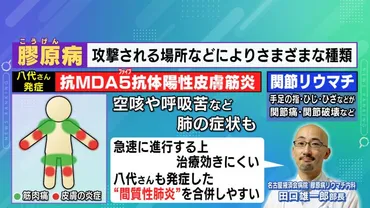 亡くなった八代亜紀さんが罹患…免疫の病気『膠原病』の初期症状とは 様々な種類あり治療方針や重篤性変わる 