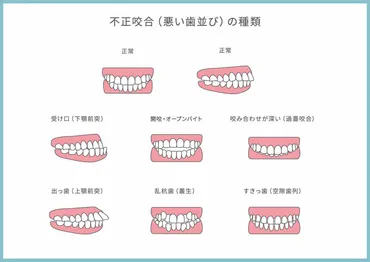 大人の歯科矯正期間は、どのくらい？治療期間と年齢の関係とは！？