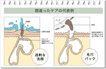 オロナインパックの毛穴ケアはなぜ危険？やり方や頻度の問題って本当？ 