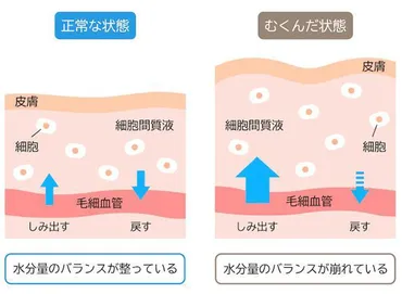 顔のむくみ、もう悩まない！〇〇でスッキリ解消できる？〇〇とは！？