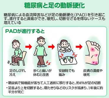 糖尿病による足の動脈硬化…進行すると足切断 命に関わることも 