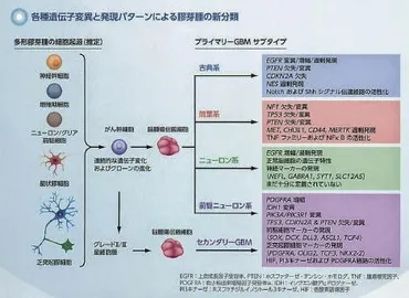 神経膠腫学における目覚ましい進歩 – WEB脳神経外科