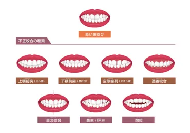 不正咬合の種類別リスクと大人になってからでも歯列矯正を ...