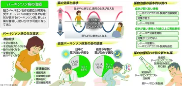 パーキンソン病…新薬次々 使い分け可能 