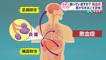 多臓器不全って一体ナニ？とは！？