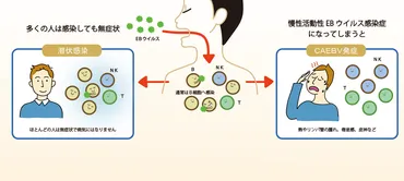 世界初のアプローチによる慢性活動性EBウイルス感染症のメカニズム解明