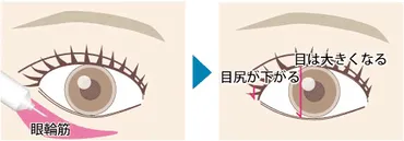 タレ目形成ってどんな手術？気になる疑問を解消！タレ目になる方法とは！？