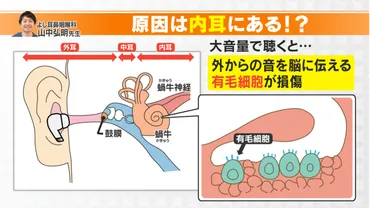 気づかないうちに難聴に！？ 世界に11億人が難聴のリスク！完治が難しい「ヘッドホン・イヤホン難聴」とは 