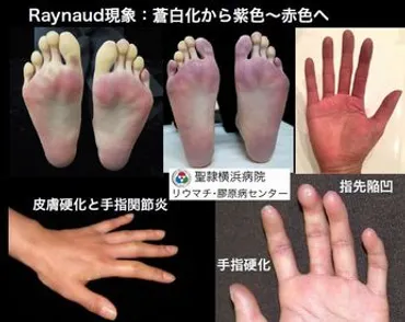 疾患別症状
