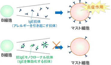 ゾレア（オマリズマブ）の作用機序：気管支喘息治療薬