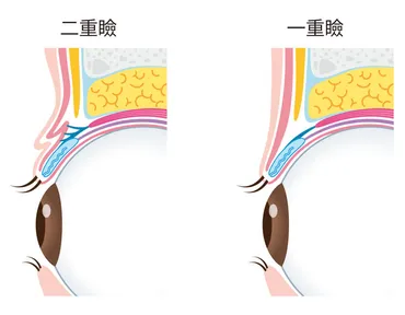 一重・奥二重さんが二重にするための８つの方法とよくあるQ＆Aを徹底解説！ 