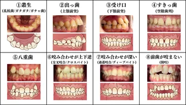 歯並びが悪くなる原因って？デメリット・治し方・費用など詳しく解説