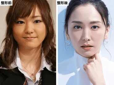 新垣結衣の顔、整形疑惑は本当？整形疑惑とは！？