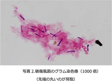 北里柴三郎と破傷風 