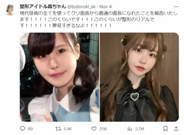 総額1350万円の整形アイドル ビフォー＆アフター公開し「このくらいが整形のリアル…夢見すぎるなよ」― スポニチ Sponichi Annex 芸能