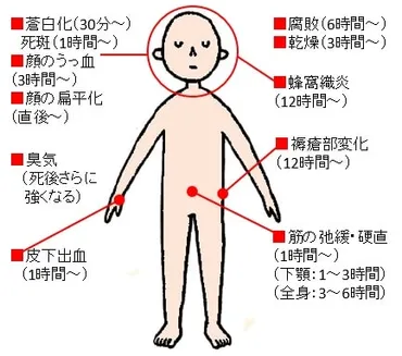 第2回 エンゼルケアの基本②死後のおもな身体の変化 