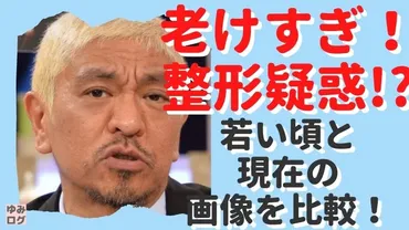 松本人志が老けすぎて劣化したのは整形のせい？若い頃と現在の画像比較！ 